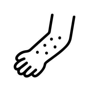 Simple Handdrawn Forearm Rash Skin Problem Healthcare Medical Illustration